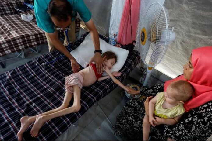 গাজায় অপুষ্টিতে অন্তত ৬৬ শিশুর মৃত্যু