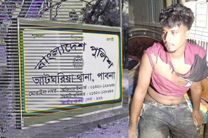 পাবনায় চোরের হামলায় প্রাণ গেলো যুবকের