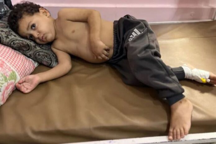 1761380531-5d1872729a350269ffff753b78e99cc5 গাজায় আহত-অসুস্থদের চিকিৎসায় বাধা দিচ্ছে ইসরায়েল