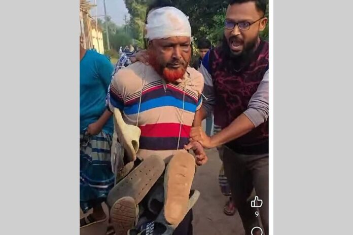 1763219651-0454bc40ea97541a07dbaf40436a11b7 নাতবউকে ধর্ষণের অভিযোগে জুতাপেটা, পুলিশে সোপর্দ