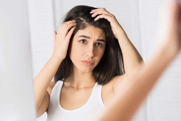 শীতে বাড়ে খুশকি, সমস্যা সমাধানে কী করণীয়