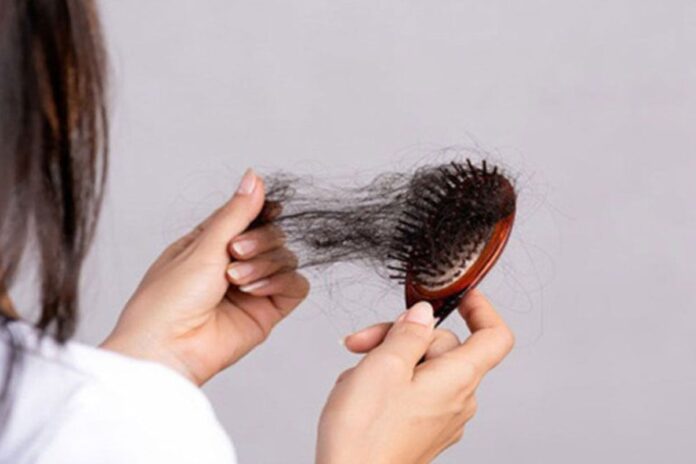 1768451513-4a9ce85c122e8b6c633518f8012b4180 চুল পড়ছে? ঘরোয়া উপায়ে মিলবে সমাধান