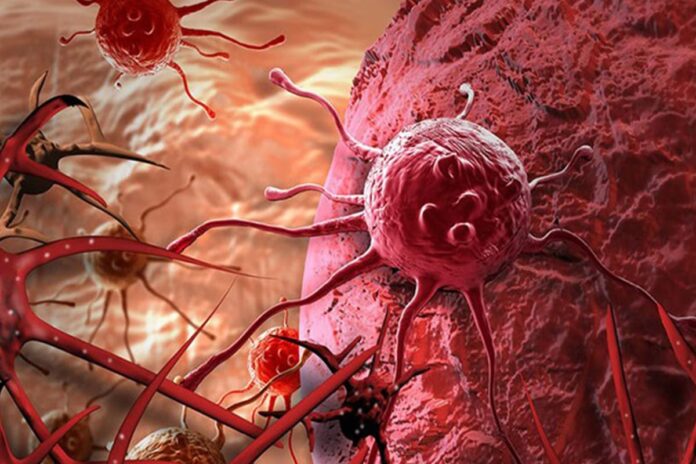 1770130427-a95704700c5dd018890a58c0aa5b2ef5 ক্যান্সার প্রতিরোধে রাষ্ট্রের অভিভাবকত্ব ও বিশ্ব ক্যান্সার দিবস ২০২৬-এর প্রতিপাদ্য