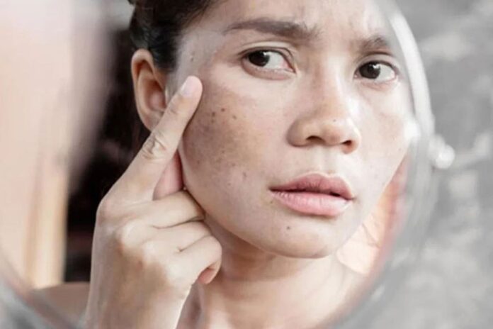 পিগমেন্টেশনের সমাধান